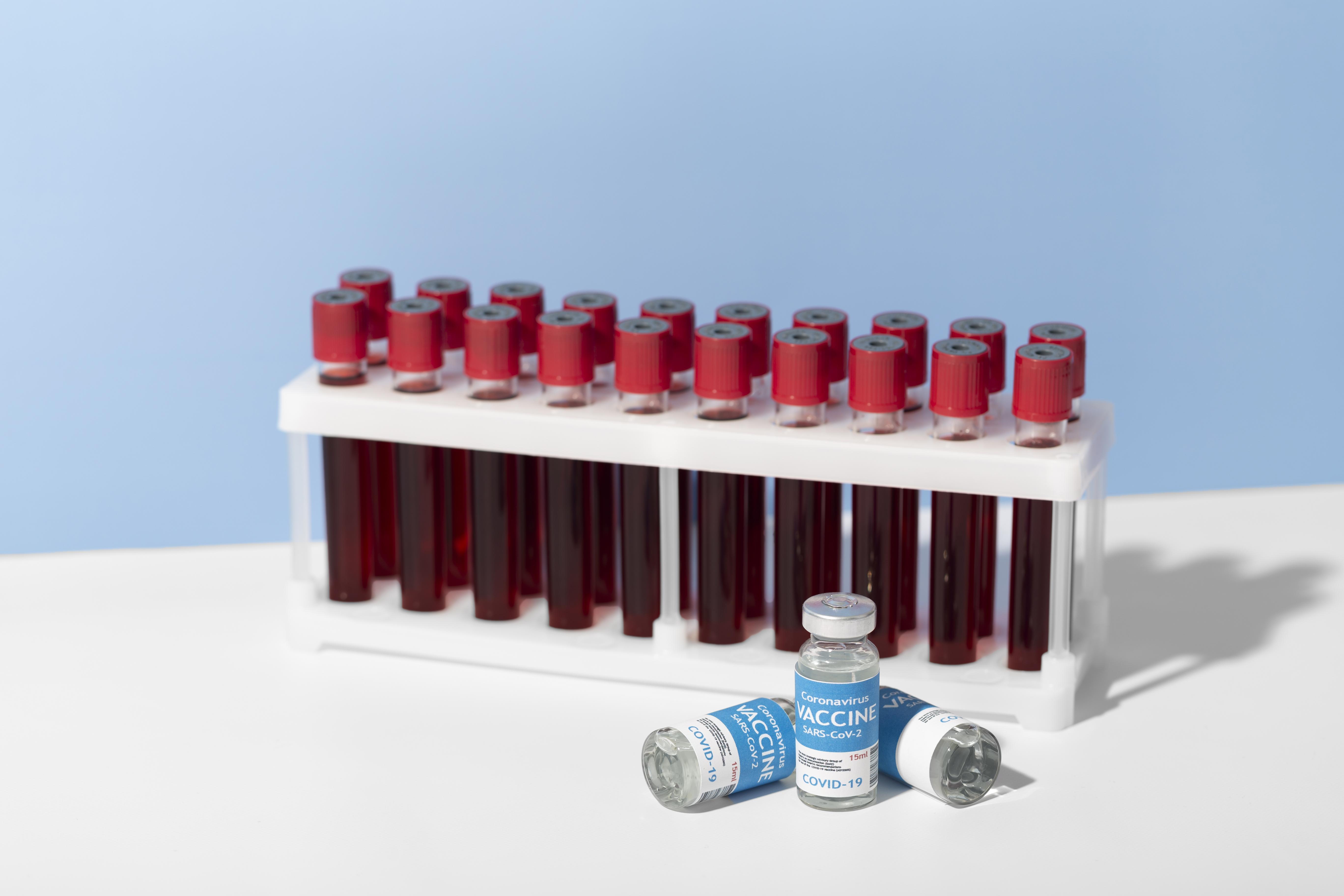Muestras de sangre y pruebas COVID-19
