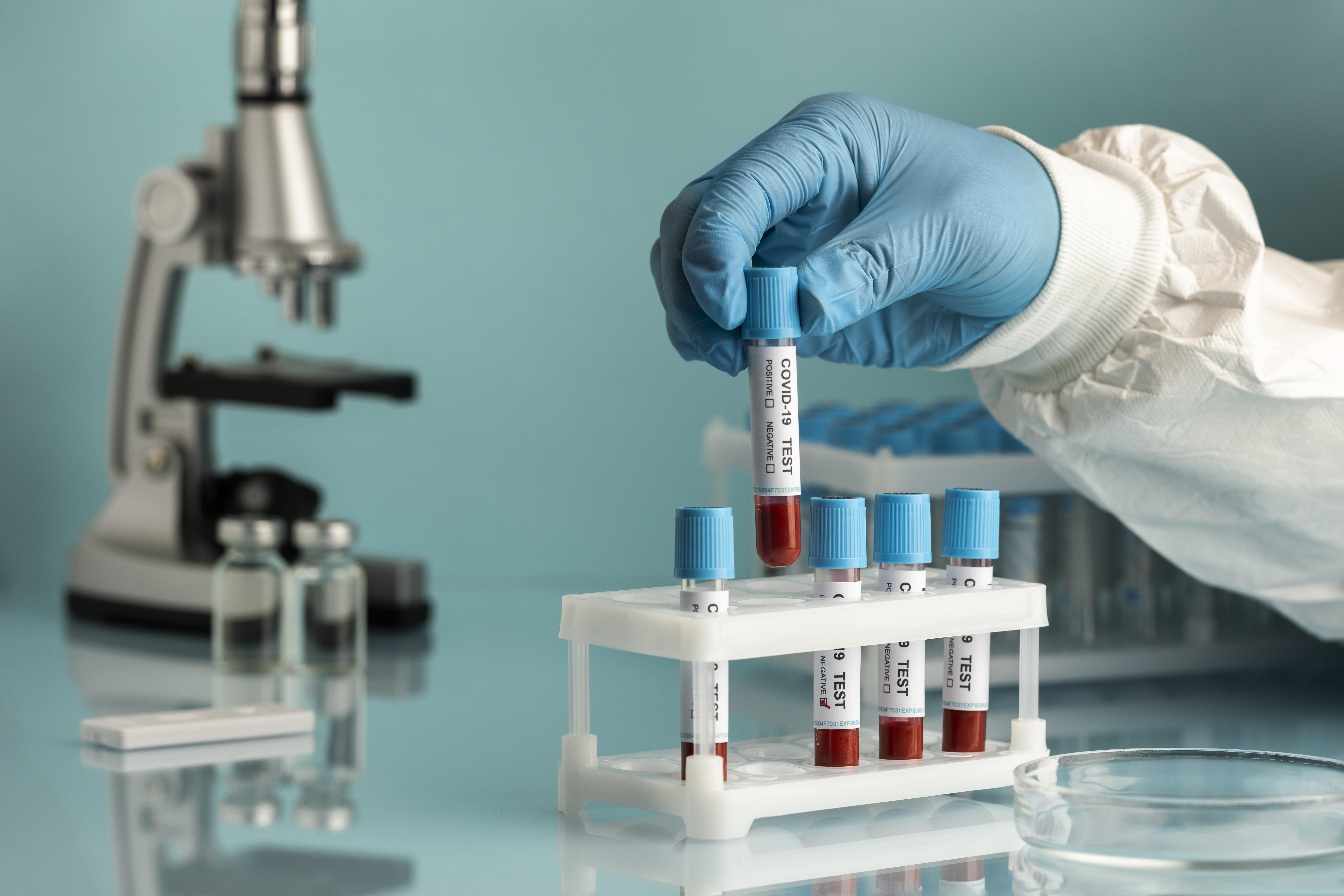 Toma de muestra con guantes protectores
